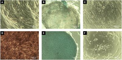 Efficacy of autologous mesenchymal stromal cell treatment for chronic degenerative musculoskeletal conditions in dogs: A retrospective study